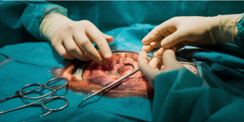 De Lagrimas à Cirurgia: Como um Erro de Diagnóstico Quase Custou a Visão